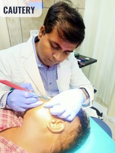Best Skin Doctor (Dermatologist), Hair Transplant & Laser Hair Removal in  Kanpur - Dermatrichs Clinic Kanpur