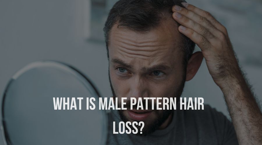 What is male pattern hair loss?