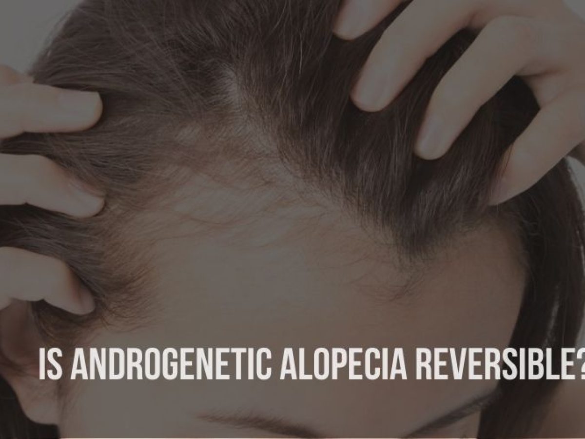 Stress-induced Alopecia - Psychogenic Alopecia | CRLAB