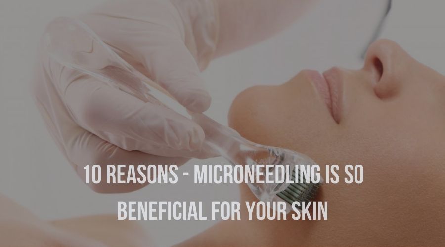 10 Reasons - Microneedling is so beneficial for your skin