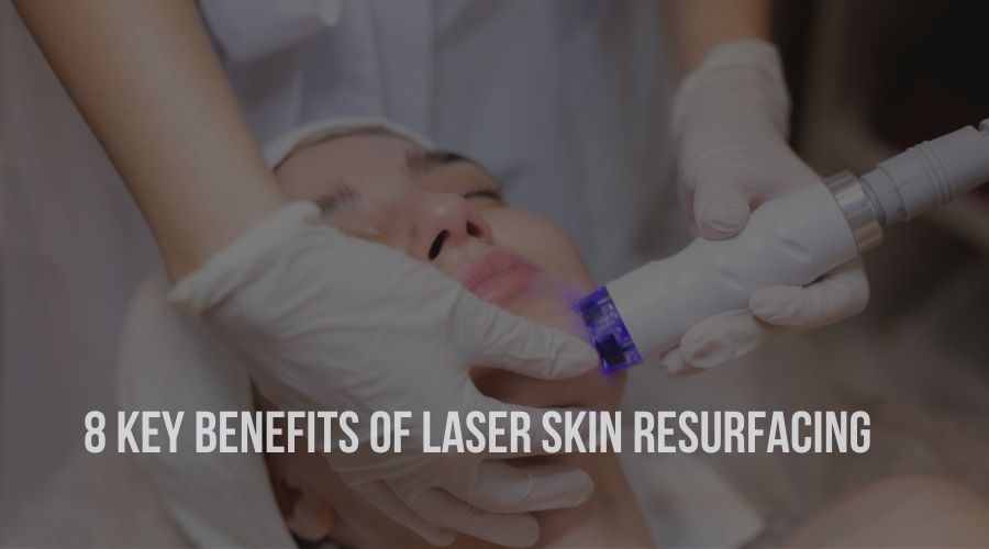 8 Key Benefits of Laser Skin Resurfacing