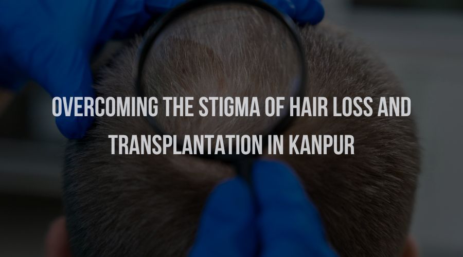 Overcoming the Stigma of Hair Loss and Transplantation in Kanpur