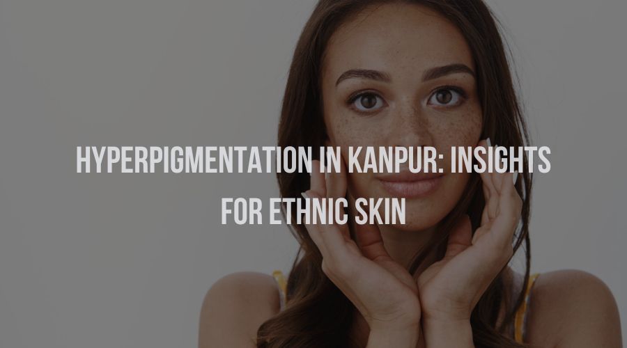 Hyperpigmentation in Kanpur: Insights for Ethnic Skin