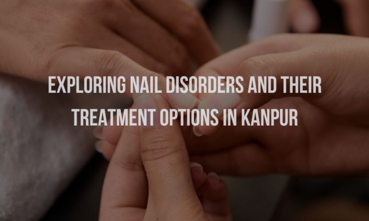 Discoloration of nail beds and skin from minocycline | CMAJ