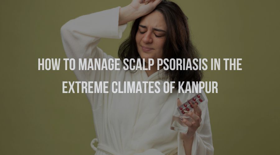 How to Manage Scalp Psoriasis in the Extreme Climates of Kanpur