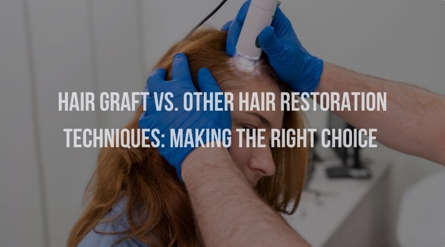 Hair Graft vs. Other Hair Restoration Techniques: Making the Right Choice