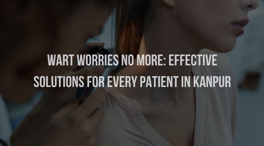Wart Worries No More: Effective Solutions for Every Patient in Kanpur