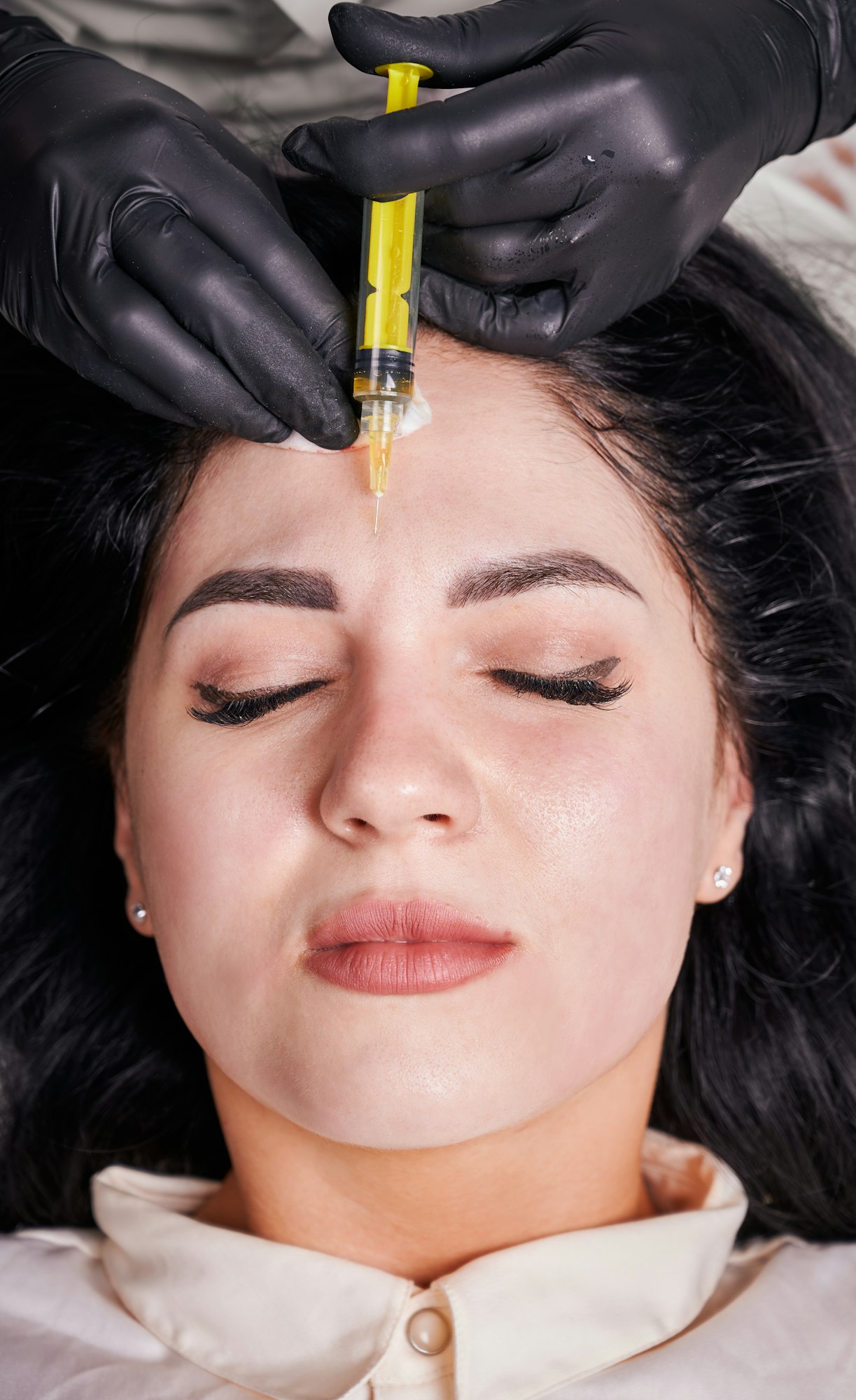Brunette girl in cosmetology office during plasmolifting procedure lying with closed eyes