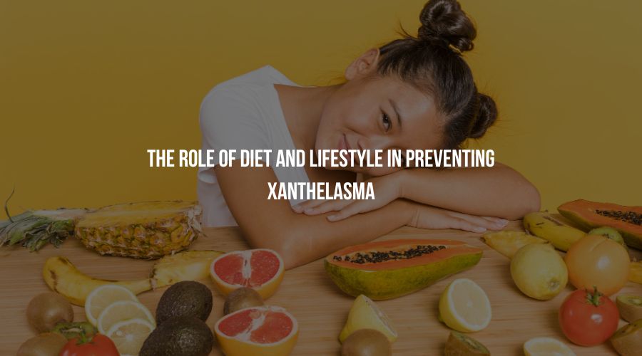 Before delving into prevention, it's essential to understand what Xanthelasma is and why it occurs