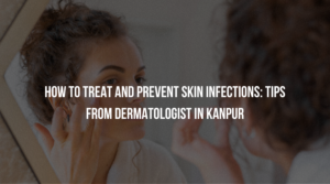 Dermatologist in Kanpur