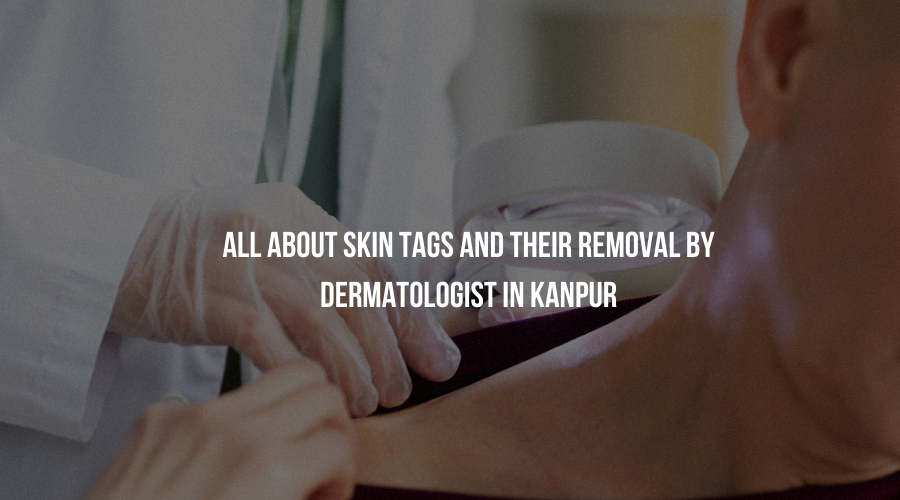 Dermatologist in Kanpur