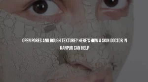 Open Pores and Rough Texture? Here’s How a Skin Doctor in Kanpur Can Help