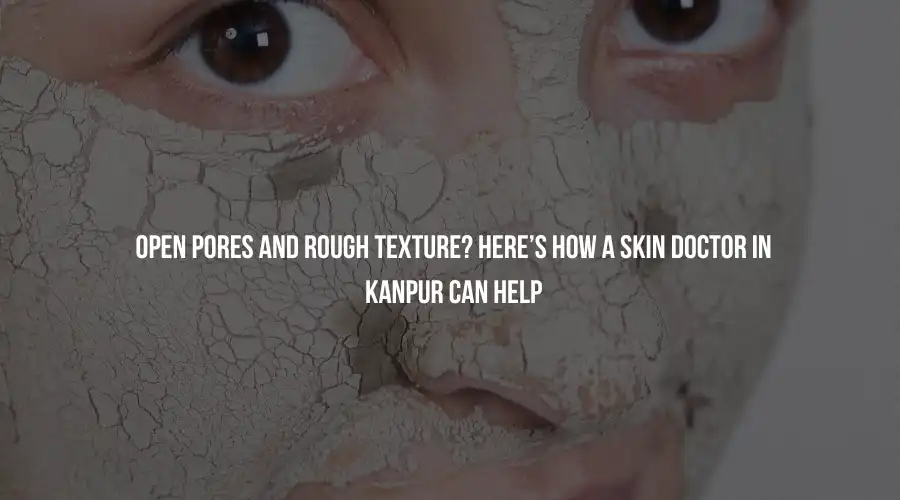 Open Pores and Rough Texture? Here’s How a Skin Doctor in Kanpur Can Help