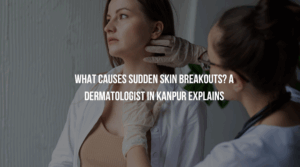 What Causes Sudden Skin Breakouts? A Dermatologist in Kanpur Explains