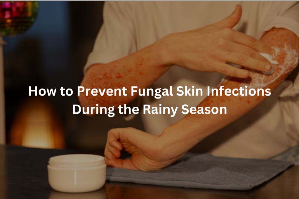 How to prevent fungal skin infections during the rainy season with proper skincare and hygiene tips.